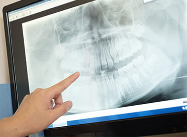 インプラント治療をはじめ、さまざまな治療の解決策をご提案します