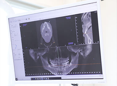 歯科用CT～精密な診断に欠かせません～