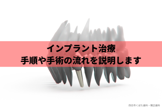 インプラント治療の手順と手術の流れを解説