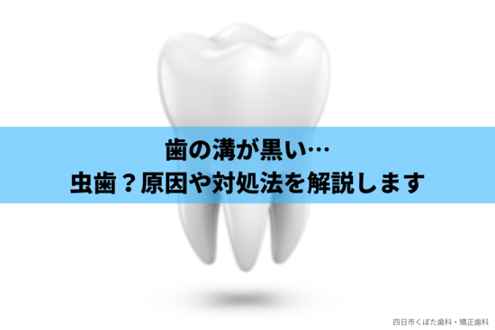 歯の溝が黒い原因は虫歯？予防・対処方法も歯科医師が解説