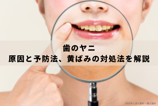 歯のヤニについて｜原因と予防法、黄ばみの対処法までまとめて解説