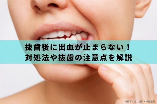 抜歯後に出血が止まらない場合の対処法｜抜歯の注意点も解説