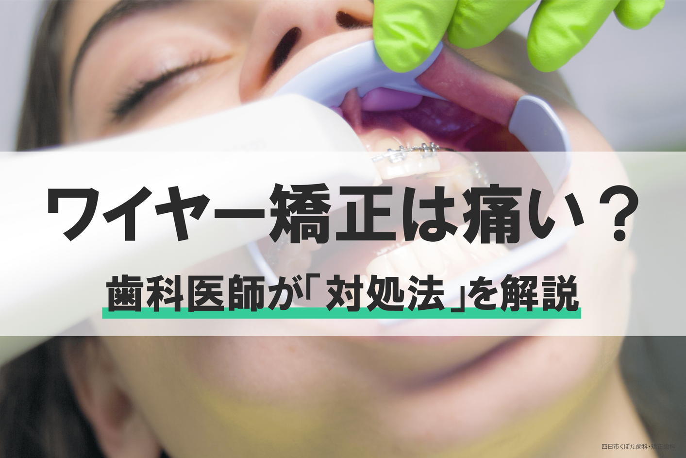 430矯正装置（ワイヤー）が刺さって痛い場合の対処法｜トラブル解消法を歯科医師が解説