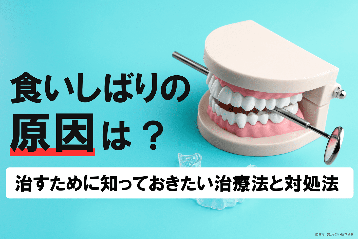474初期虫歯は治療したほうがいいの？