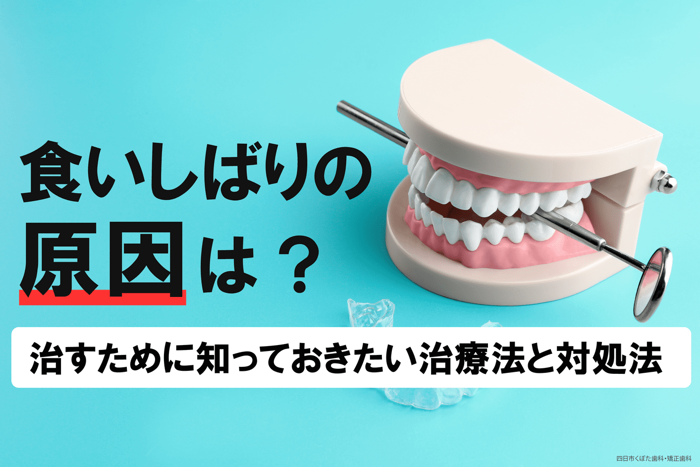 食いしばりの原因は？治すために知っておきたい治療法と対処法