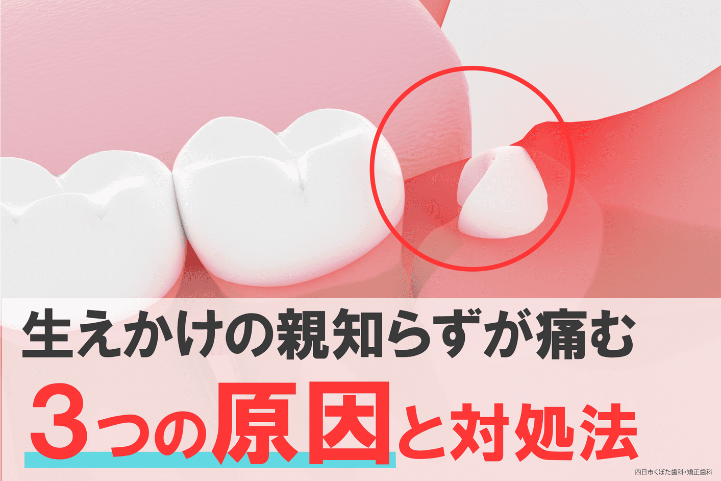 513痛くないけど歯磨きをすると毎日血が出る！原因や対処法とは