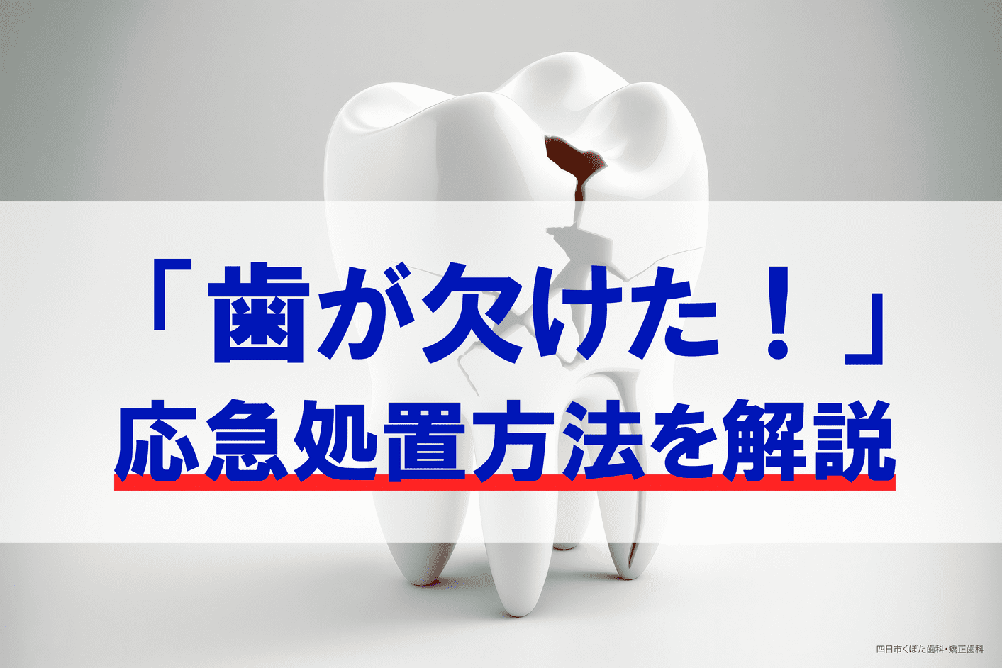 歯が欠けた場合の3つの対処法！すぐに歯医者に行けない時の応急処置のやり方も解説