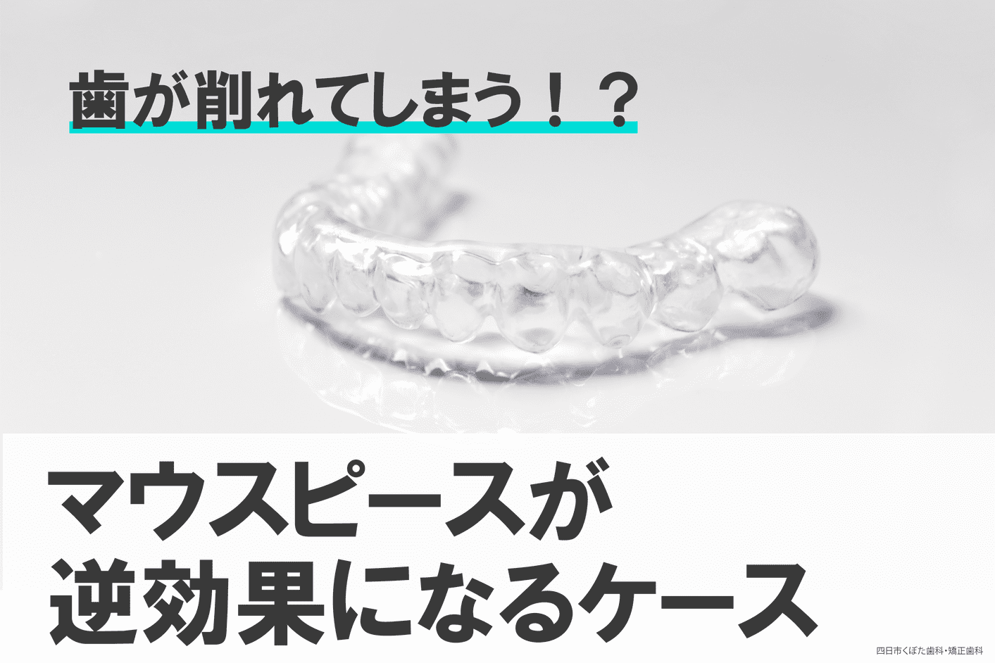 歯が削れてしまう!?食いしばり用のマウスピースが逆効果になるケースとは