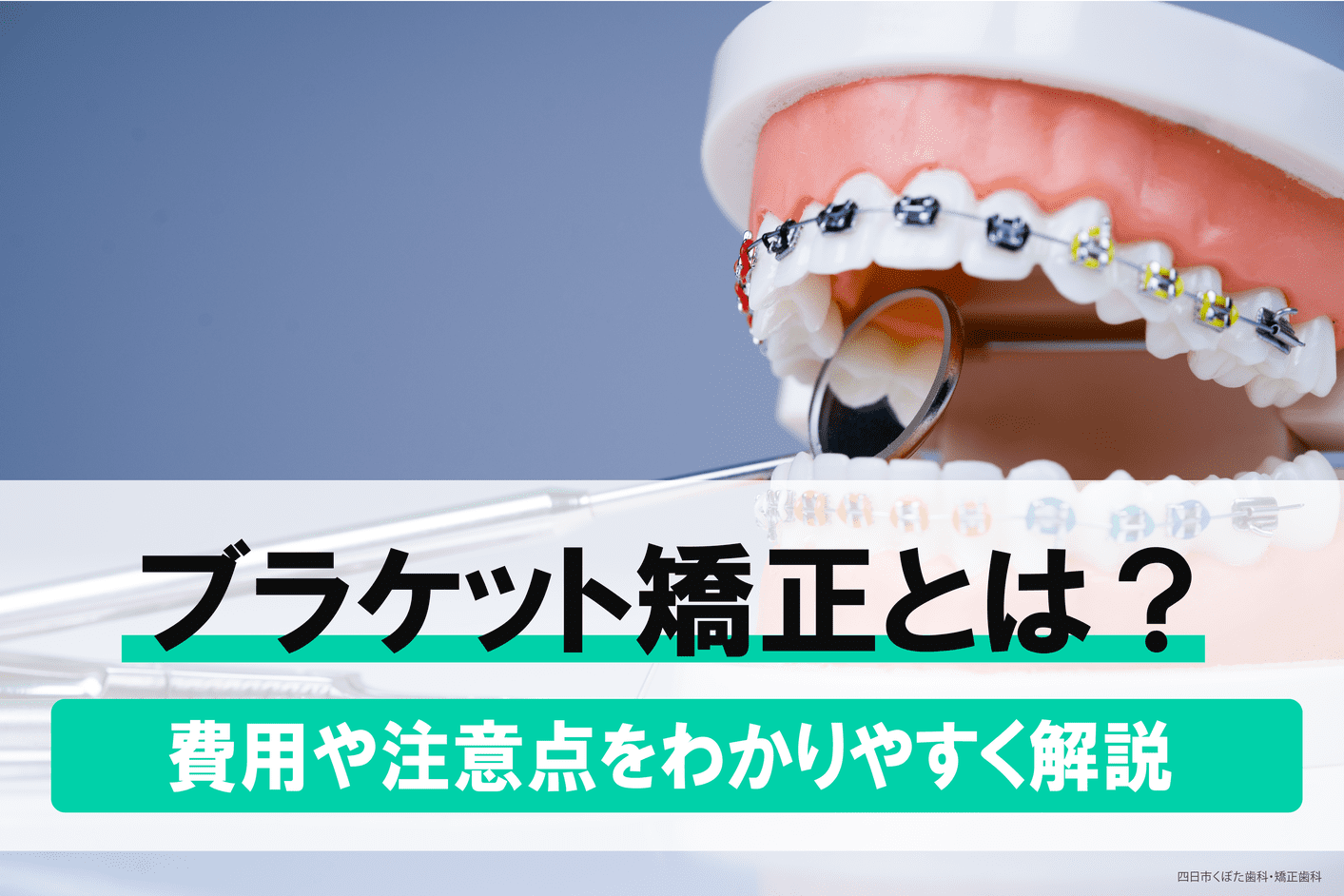 ブラケット矯正とは｜メリットとデメリット・費用・注意点をわかりやすく解説